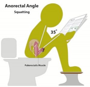 7 Toilet Positions To Relieve Constipation - Bladder & Bowel Community